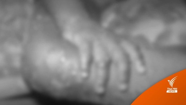 Anti-Monkeypox measures introduced at Thai airports Anti-Monkeypox measures introduced at Thai airports