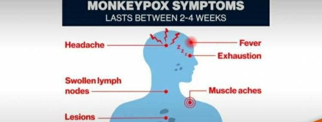 Suitable private labs to be allowed to test for monkeypox, no new case yet Suitable private labs to be allowed to test for monkeypox, no new case yet