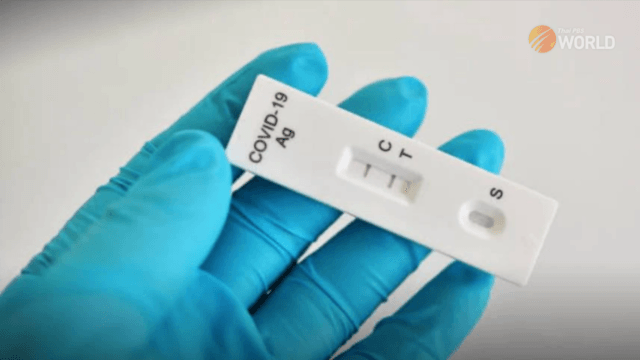 Rapid antigen test not needed after recovering from COVID-19 infection Rapid antigen test not needed after recovering from COVID-19 infection
