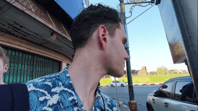 Swedish tourist attacked by monkey in Lop Buri Swedish tourist attacked by monkey in Lop Buri
