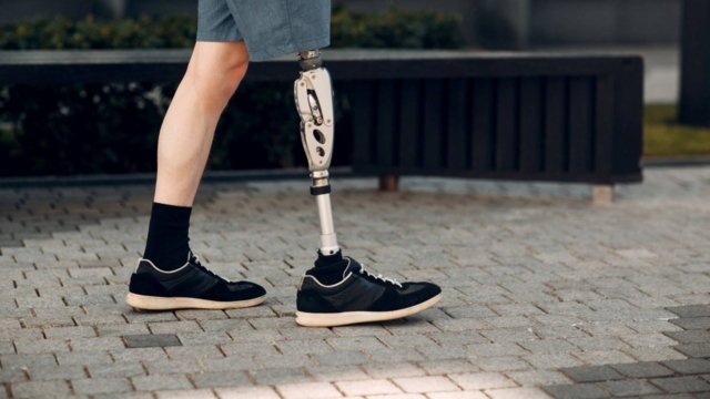 Police officer with prosthetic leg regains right to promotion Police officer with prosthetic leg regains right to promotion