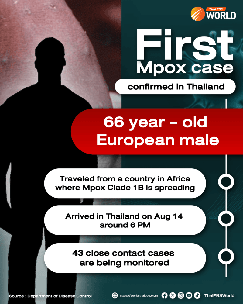First Mpox case confirmed in Thailand