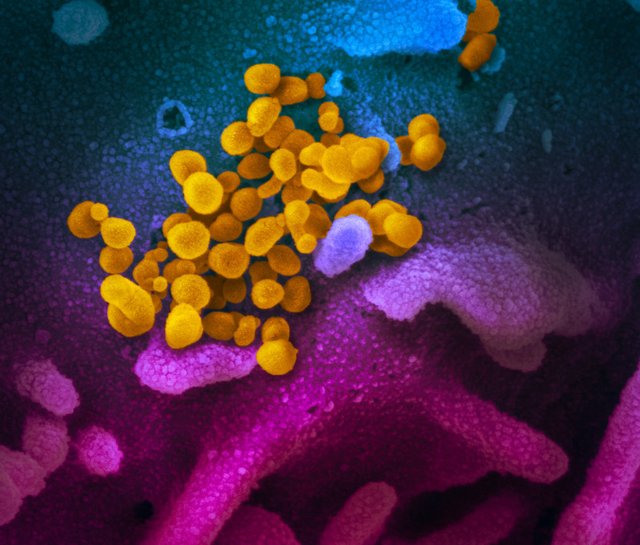 Over 200 Omicron cases confirmed in Thailand, Kalasin -Udon Thani cluster of concern Over 200 Omicron cases confirmed in Thailand, Kalasin -Udon Thani cluster of concern