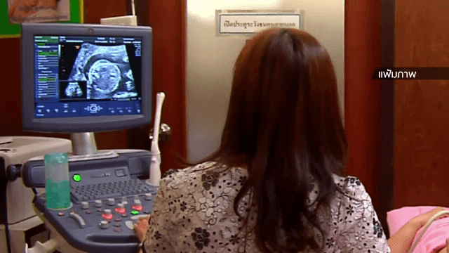 Thai Health Dept says COVID-infected mothers can breastfeed with caution Thai Health Dept says COVID-infected mothers can breastfeed with caution