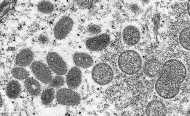 Thailand reports its 12th monkeypox case Thailand reports its 12th monkeypox case