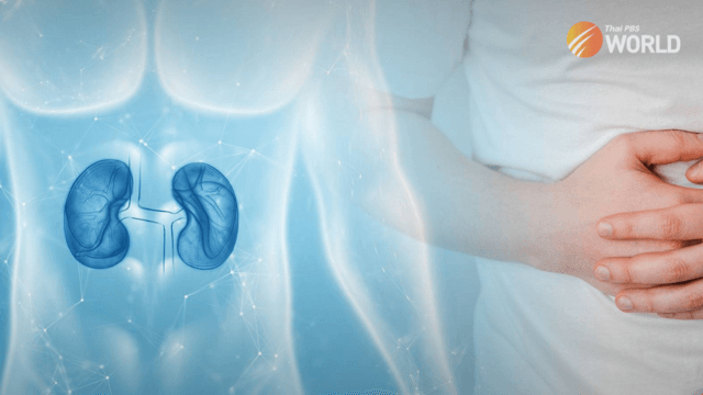 Eating too much sodium blamed for high rate of kidney disease in Thailand Eating too much sodium blamed for high rate of kidney disease in Thailand