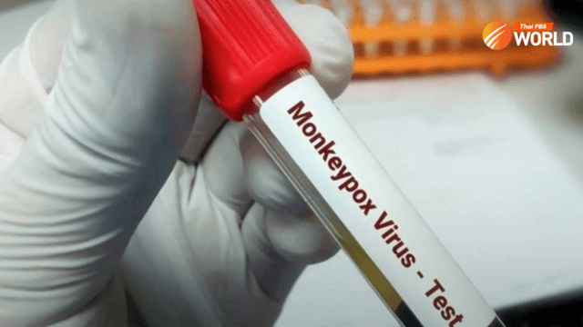Monkey pox is on the rise after Songkran Monkey pox is on the rise after Songkran