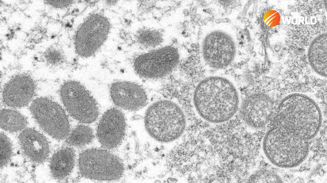 Thailand Records 48 New Cases of Monkeypox Virus in June