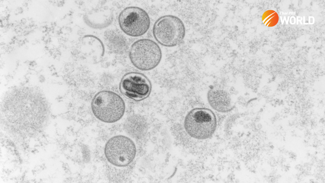 Smallpox vaccine cannot prevent monkeypox infection – Thai Medical Sciences Department